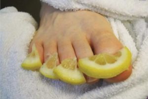 Варианты народных методов лечения грибка на ногах
