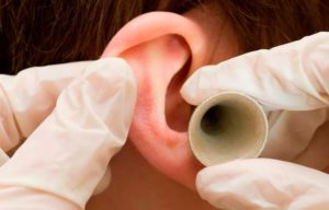 Грибок в ушах у человека - лечение и симптомы с фото