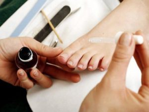 Использование креолина при грибке ногтей на ногах