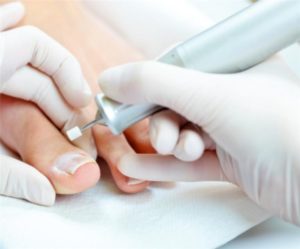 Медицинский педикюр и грибок ногтей на ногах