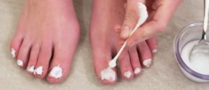 Как вылечить грибок на ногтях ног при помощи уксуса thumbnail